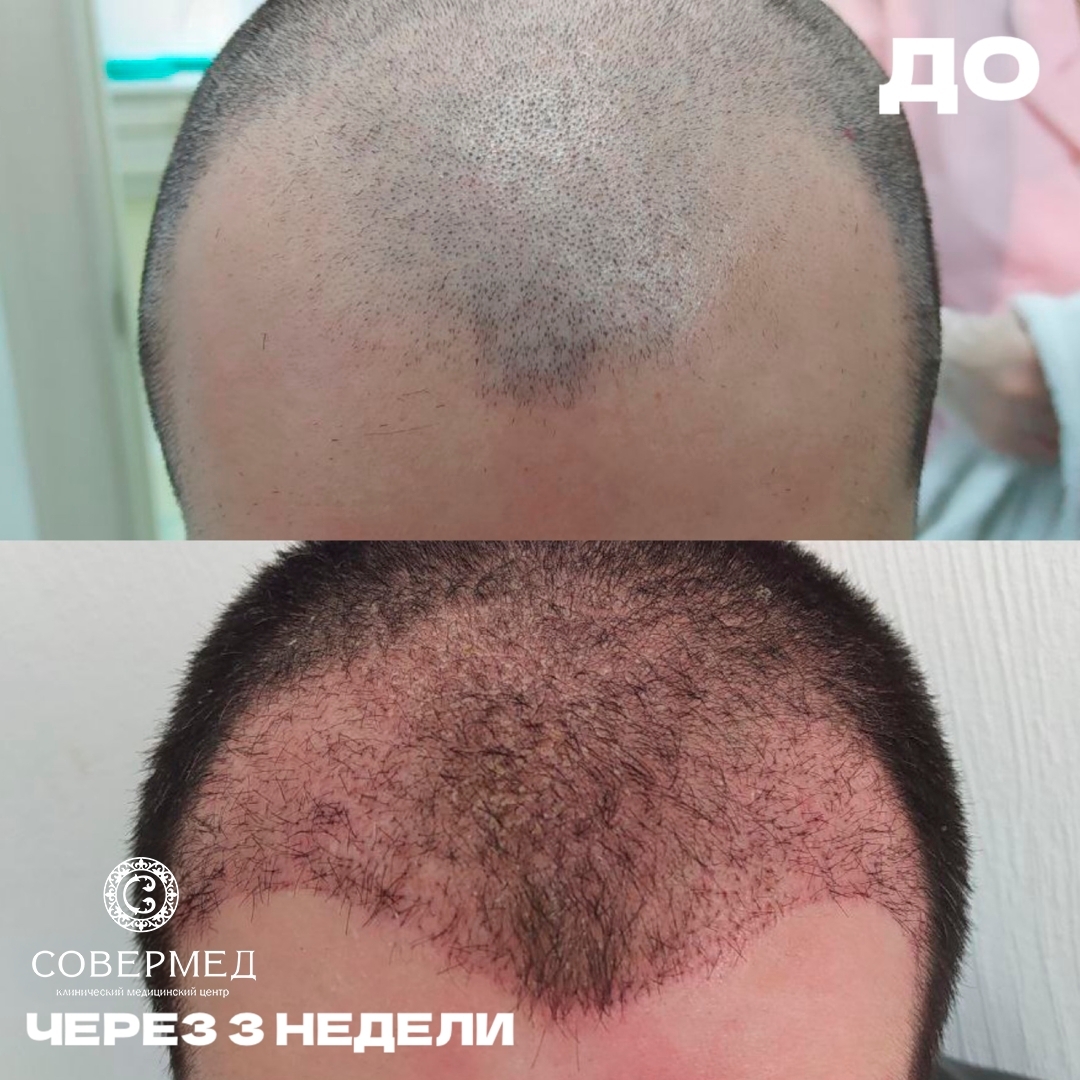 Волосы — работа 10