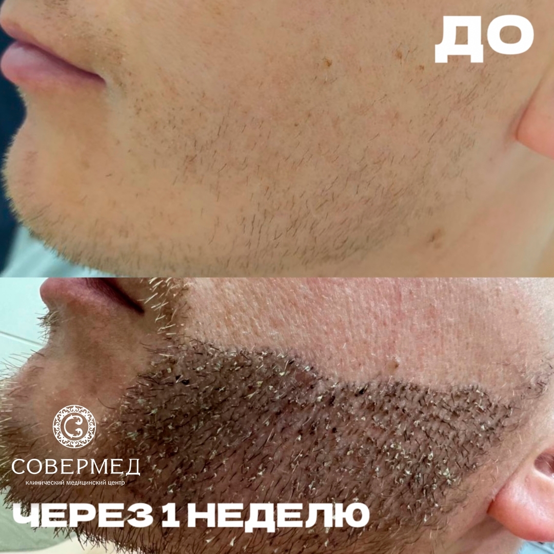Борода — работа 4