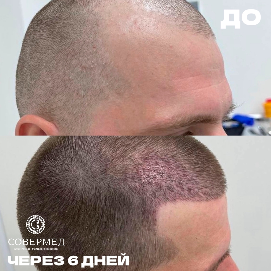 Волосы — работа 20