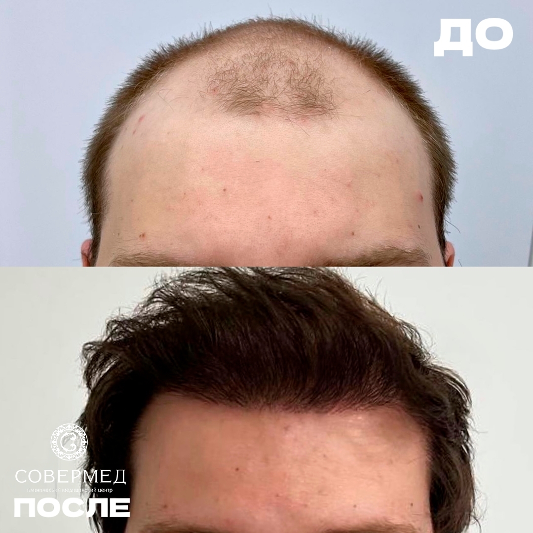 Волосы — работа 21
